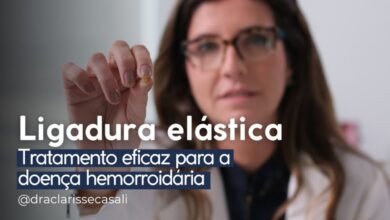 Ligadura Elástica para Hemorroidas: Entenda por que é uma opção eficaz