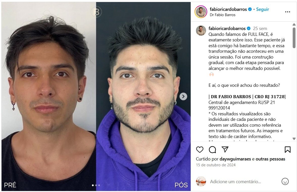 Dr Fabio Ricardo Barros - CRO-RJ – 31728 - Cirurgião Dentista