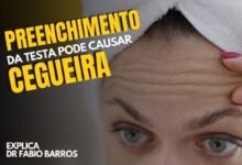Preenchimento na testa pode causar cegueira