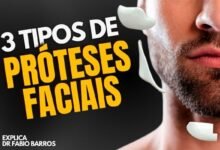 3 Tipos de Próteses Faciais: Entenda Qual é a Melhor Opção Para Você