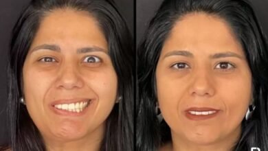Projeto Social para Pacientes com Paralisia Facial Retorna com Apoio da Copaderma