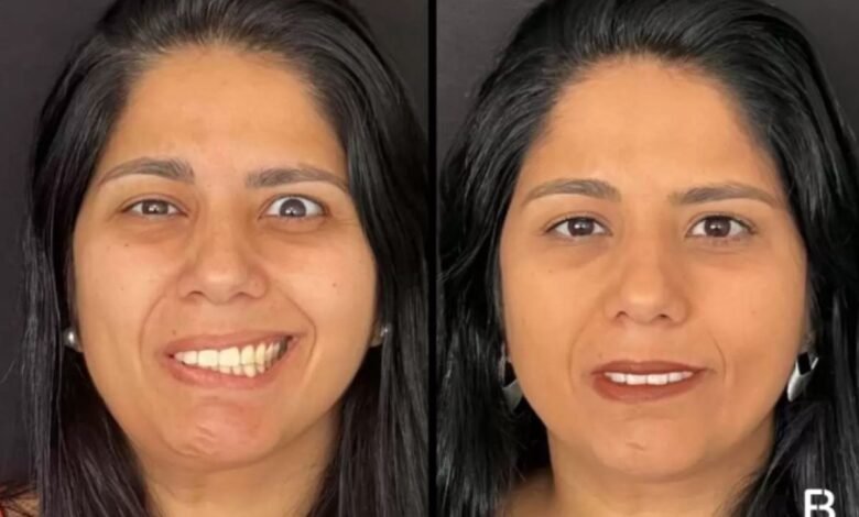 Projeto Social para Pacientes com Paralisia Facial Retorna com Apoio da Copaderma